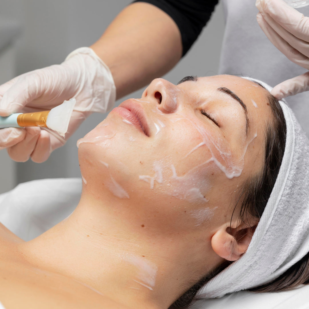 Deep chemical peel facial treatment at Haus of Youth in North Hollywood